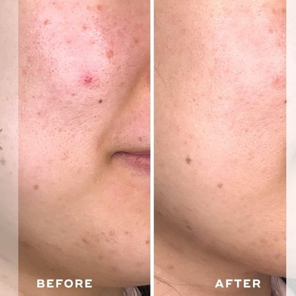 ACEOLOGY DETOXIFYING TREATMENT MASK•65 ml - Picture 4 of 8